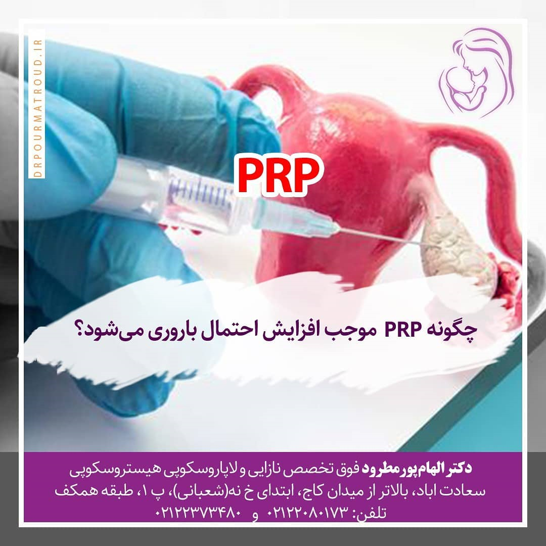 PRP تخمدان